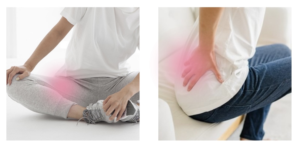 骨盤×股関節矯正