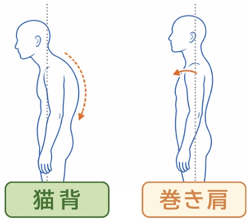 猫背と巻き肩の違いのイメージ