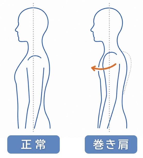 巻き肩の姿勢イメージ