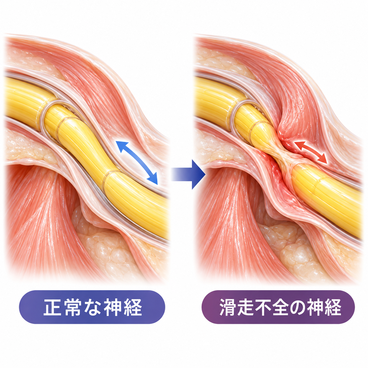神経の動きを示すイメージ