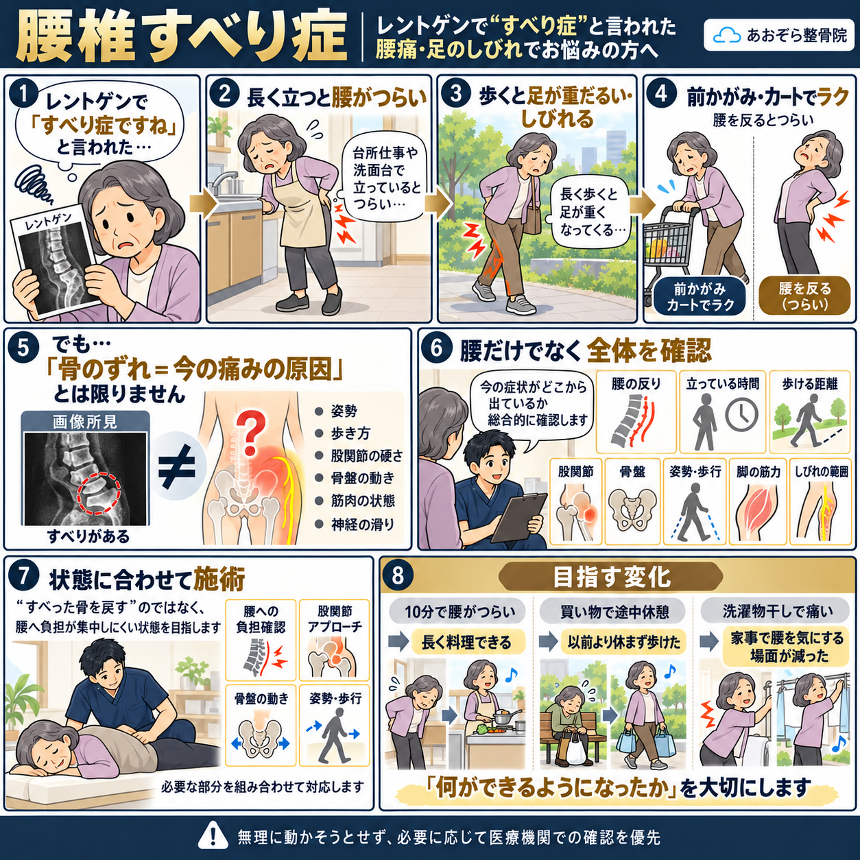 腰椎すべり症について分かりやすく解説
