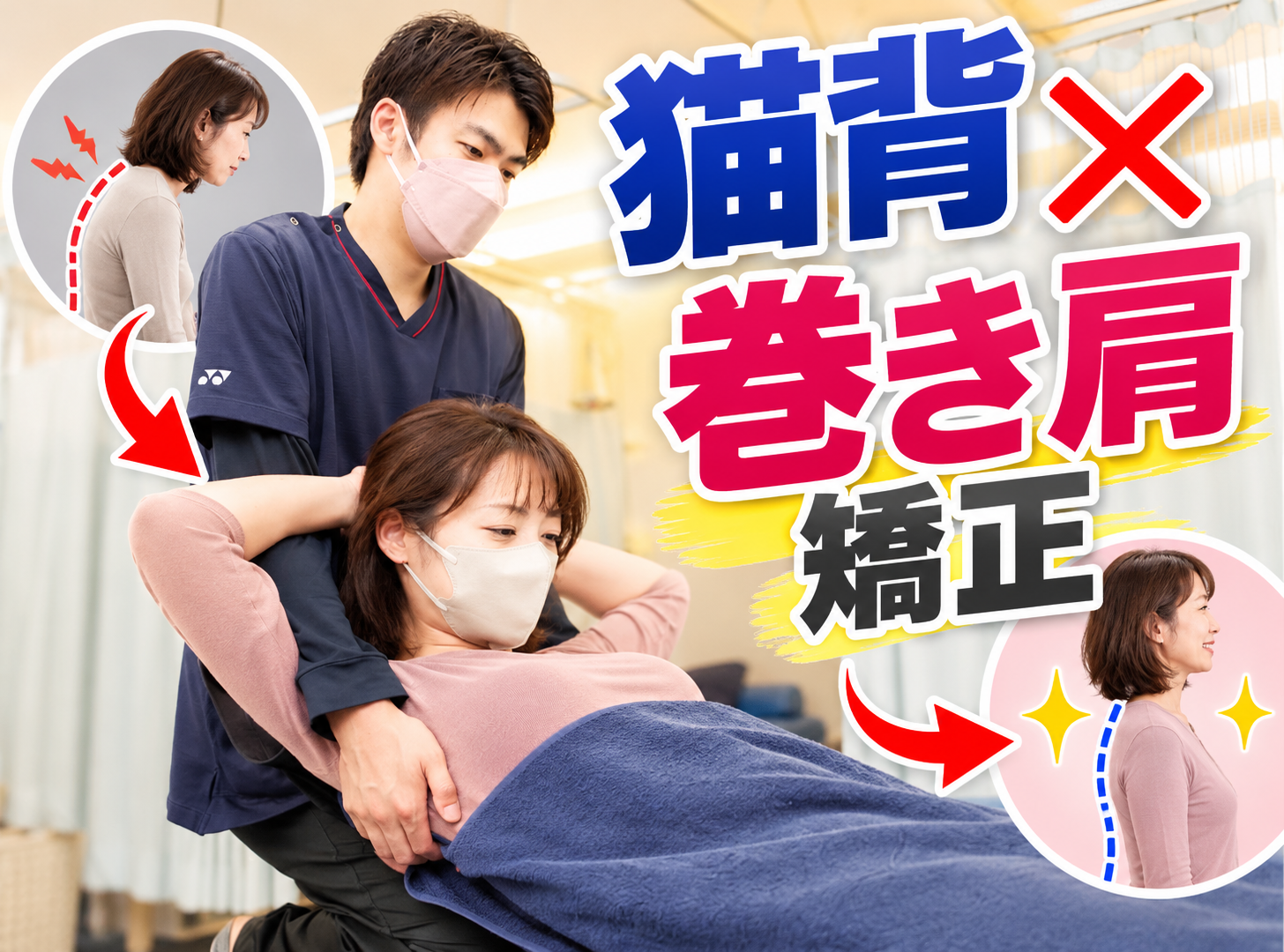 猫背×巻き肩矯正の施術動画サムネイル